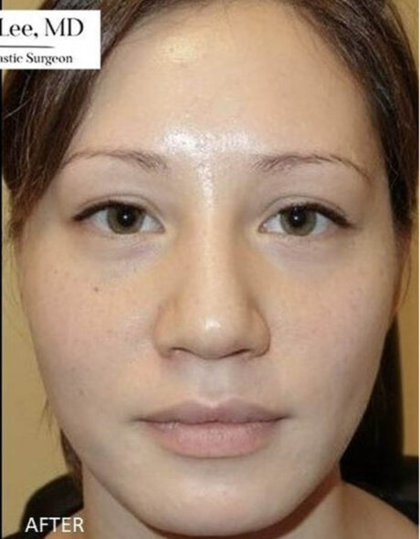 BOTOX® & Dysport case #12666